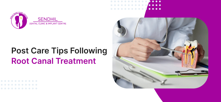 Root Canal Treatment