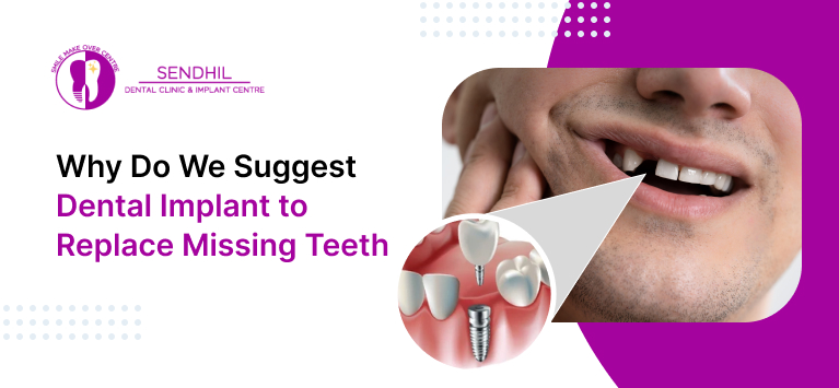 dental implant to replace missing teeth