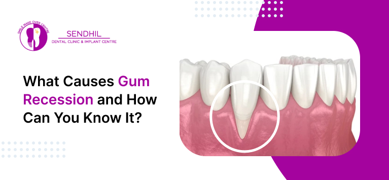 gum recession