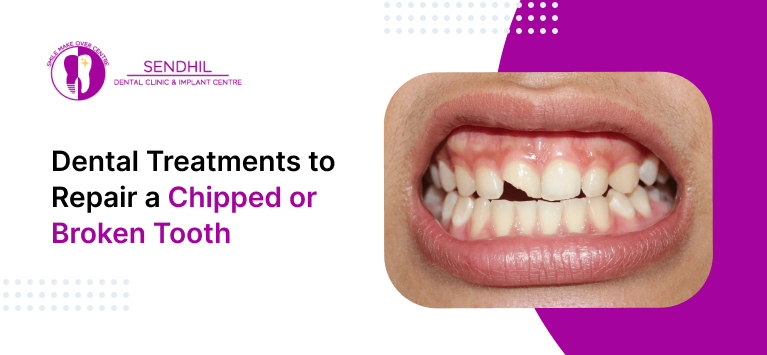 Dental Treatments to repair a chipped or broken tooth