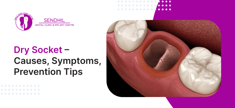 Dry Socket – Causes, Symptoms, Prevention Tips