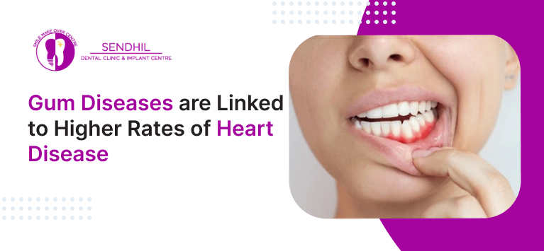 Gum diseases are linked to higher rates of heart disease