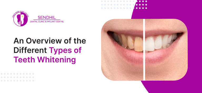 An Overview of the Different Types of Teeth Whitening