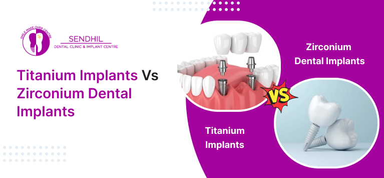 Titanium Implants Vs Zirconium Dental Implants