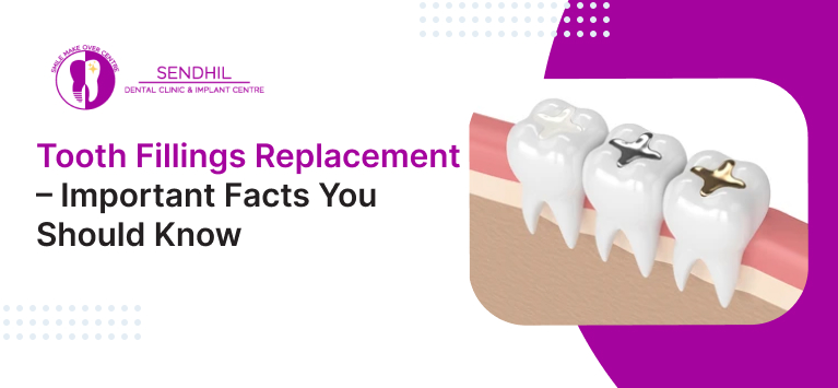 Tooth Fillings Replacement – Important facts you should know