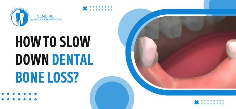 How to slow down dental bone loss?