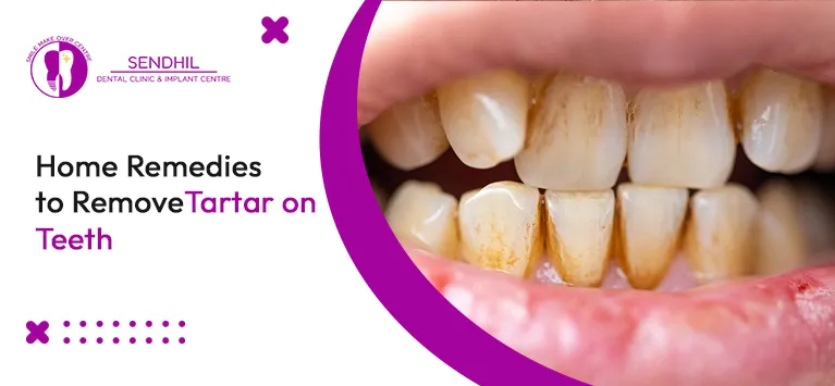 7 Home Remedies to Remove Tartar on teeth