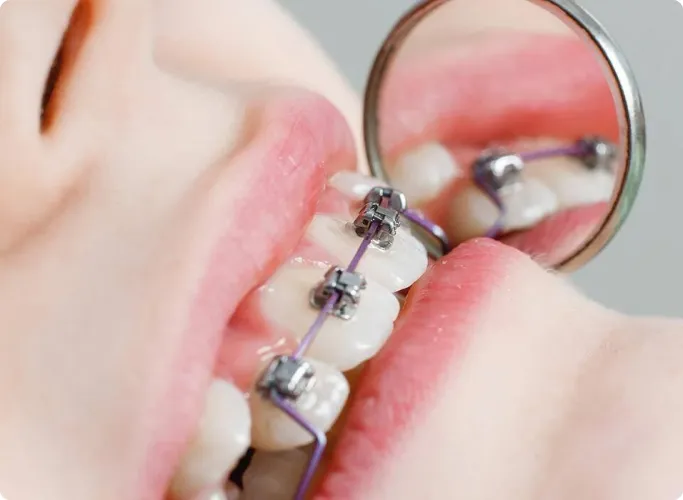 Best Orthodontists in Chennai