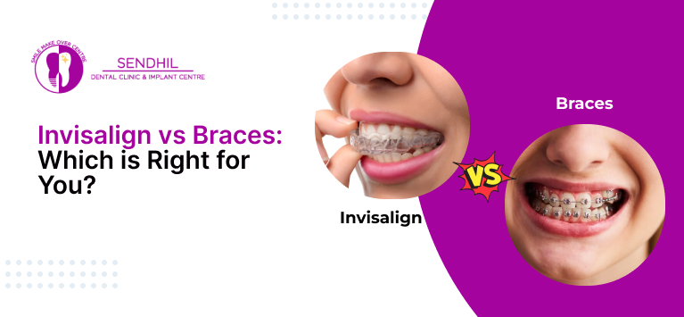 Invisalign vs braces