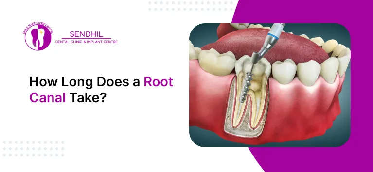 how long does a root canal take