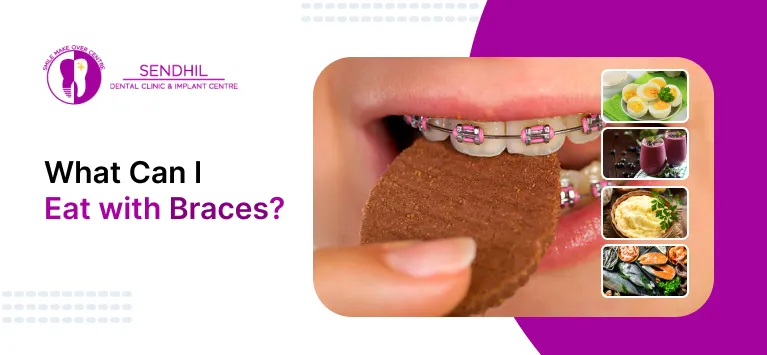 what can i eat with braces