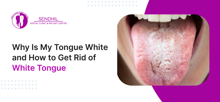 white tongue pictures