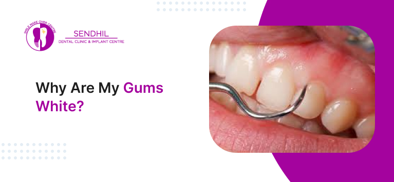 pictures of white gums