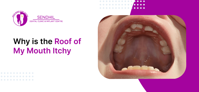 itchy roof of mouth pictures