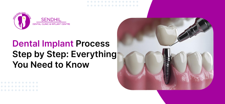 step by step dental implant procedure photos