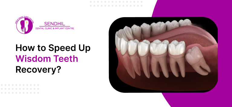 How to Speed Up Wisdom Teeth Recovery