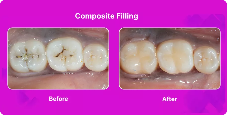 Treatable Case Image
