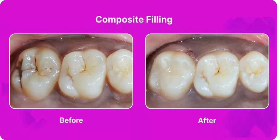 Treatable Case Image