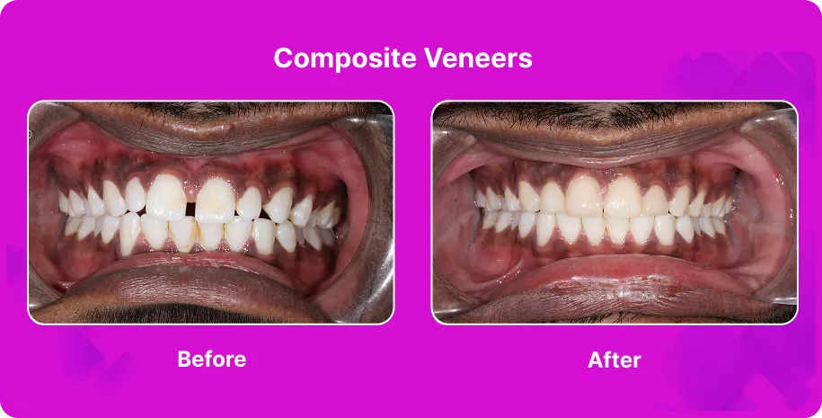 Treatable Case Image