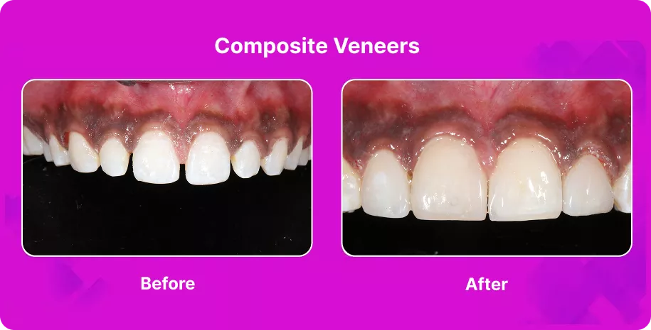 Treatable Case Image