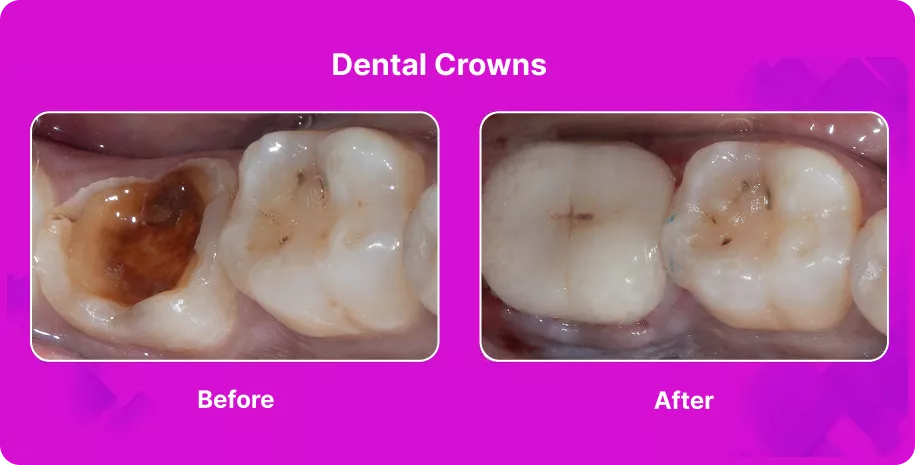 Treatable Case Image