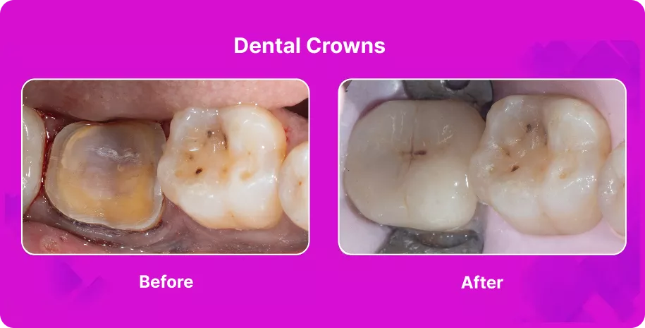 Treatable Case Image