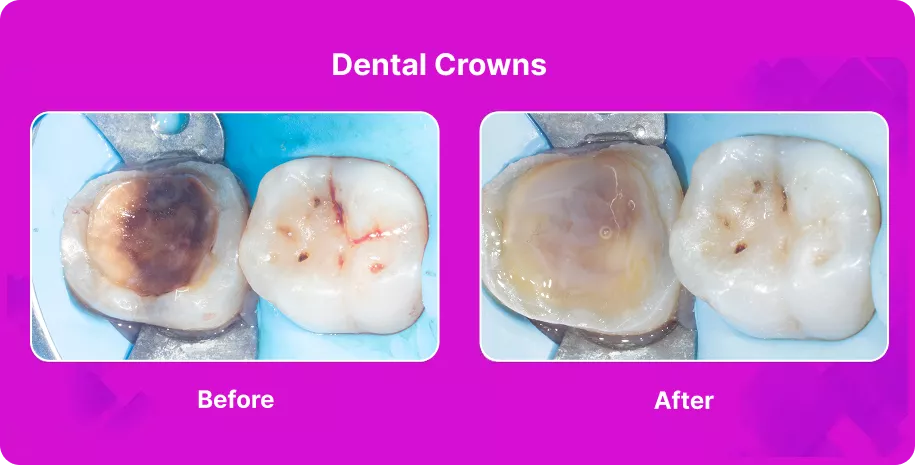 Treatable Case Image