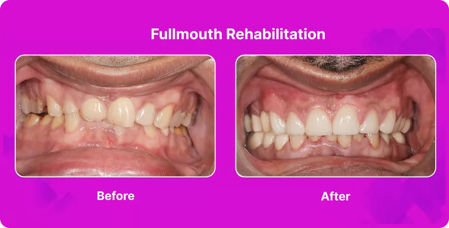 Treatable Case Image