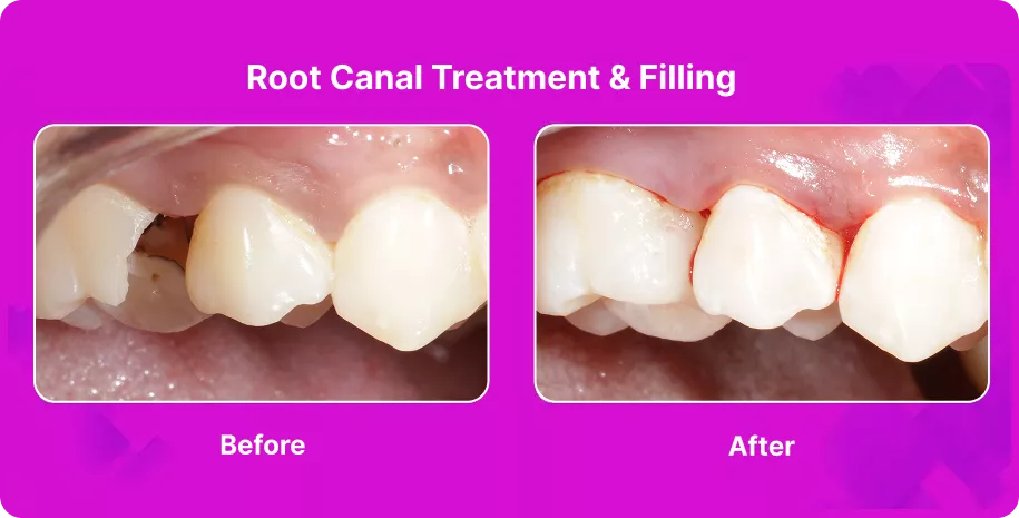 Treatable Case Image