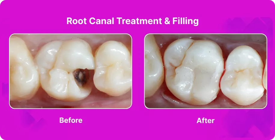 Treatable Case Image