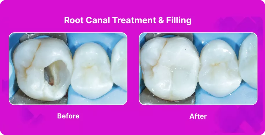 Treatable Case Image