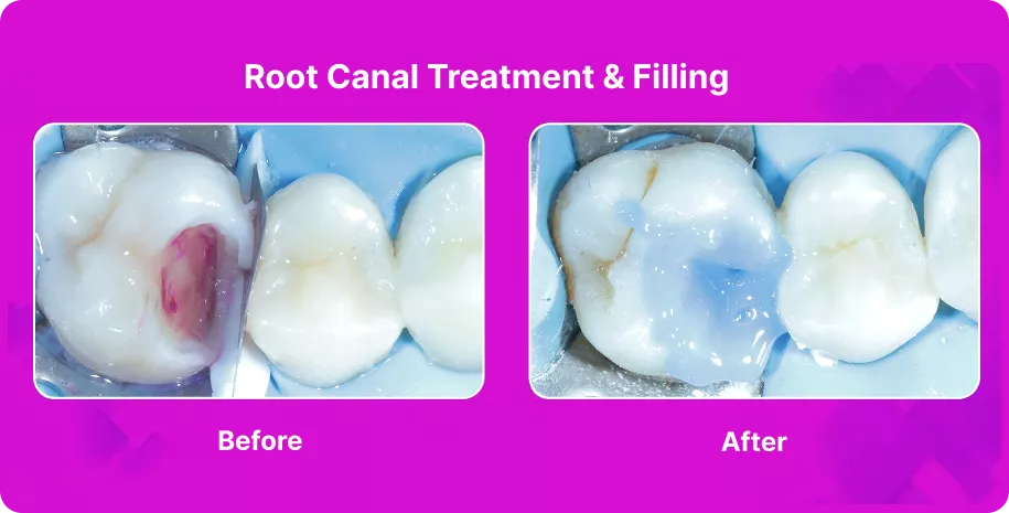 Treatable Case Image