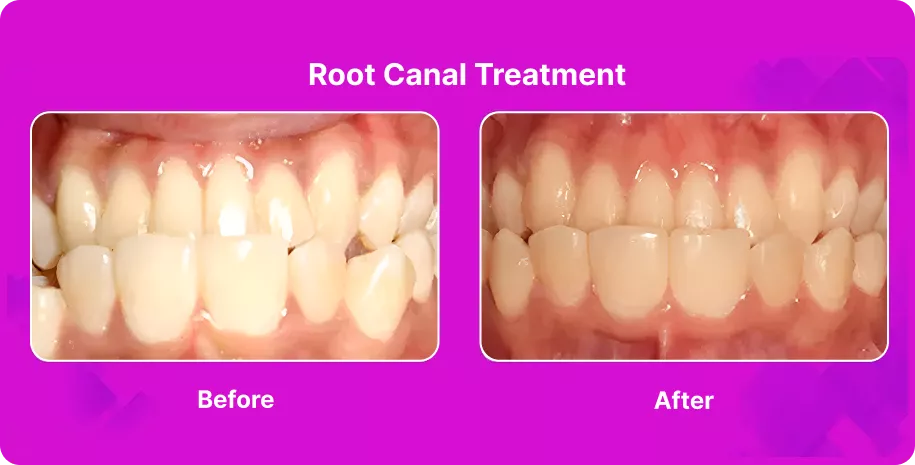 Treatable Case Image