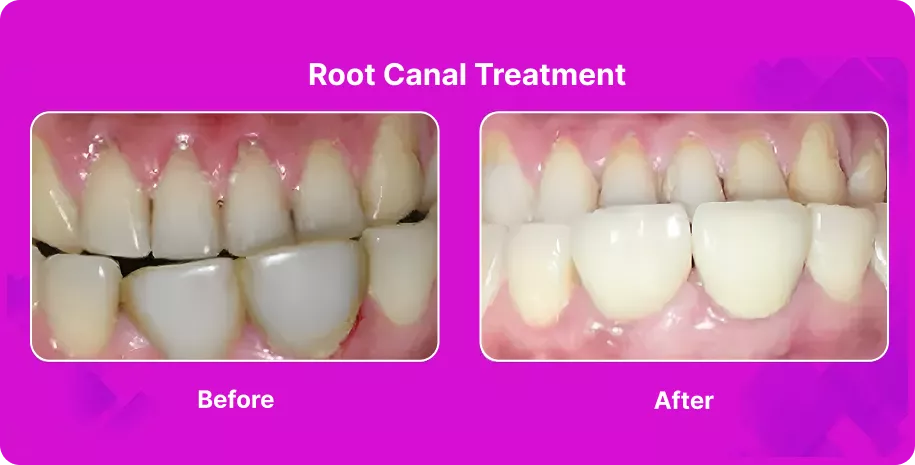 Treatable Case Image