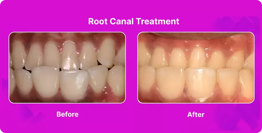 Treatable Case Image