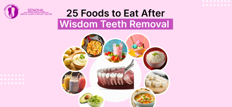 25 foods to eat after wisdom tooth removal