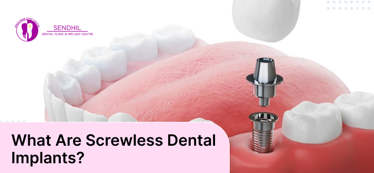 pictures of screwless dental implants