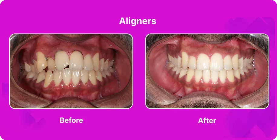 Treatable Case Image