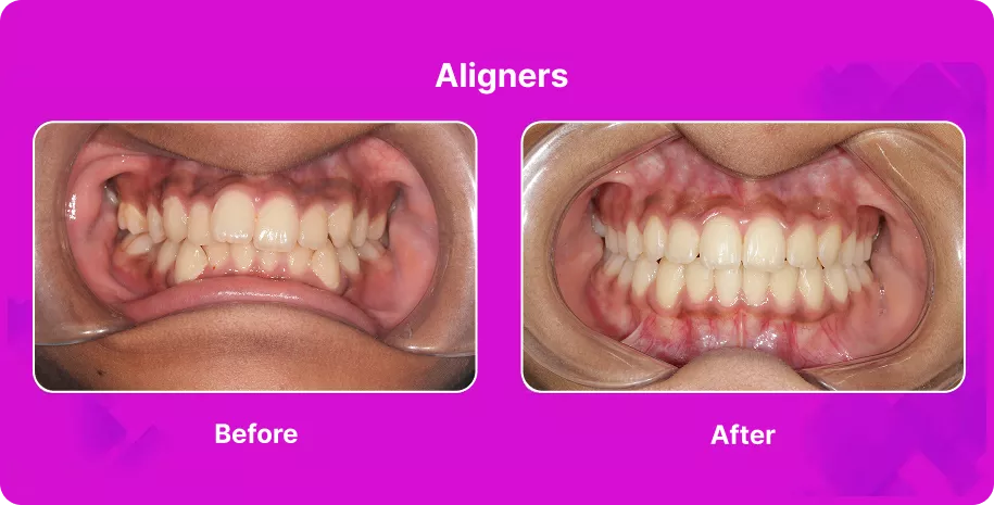 Treatable Case Image
