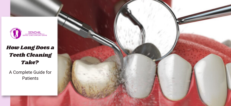 How Long Does a Teeth Cleaning Take