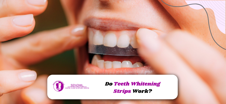 Do Teeth Whitening Strips Work