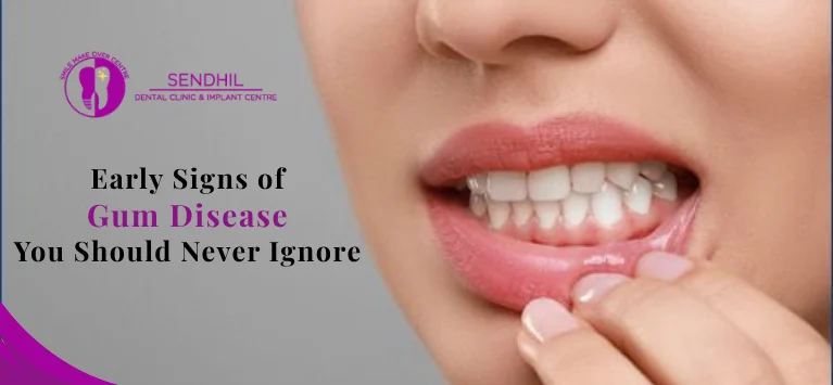 Early-signs-of-gum-disease