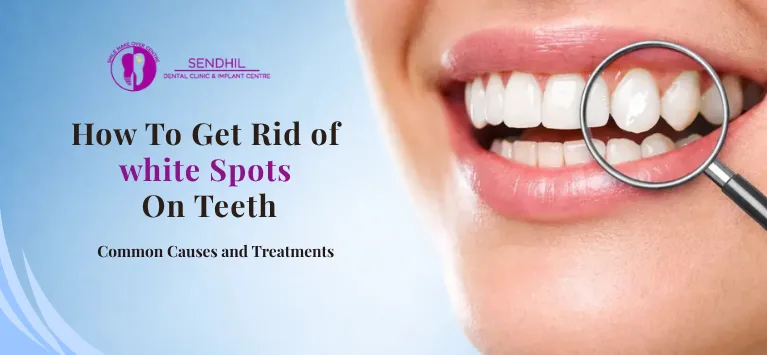 How-to-get-rid-of-white-spots-on-teeth