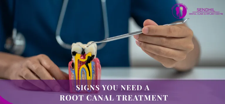 Signs-You-Need-a-Root-Canal-Treatment.