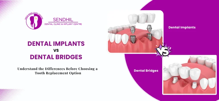 Dental-Implants-vs-Dental-Bridges