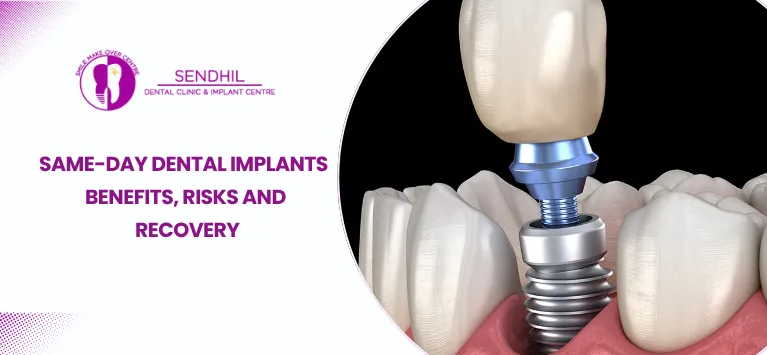 Same-Day-Dental-Implants
