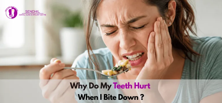 Why-Do-My-Teeth-Hurt-When-I-Bite-Down
