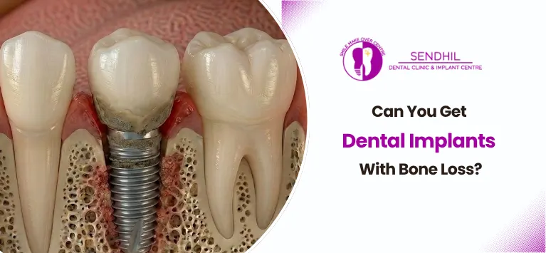 Can-You-Get-Dental-Implants-With-Bone-Loss.
