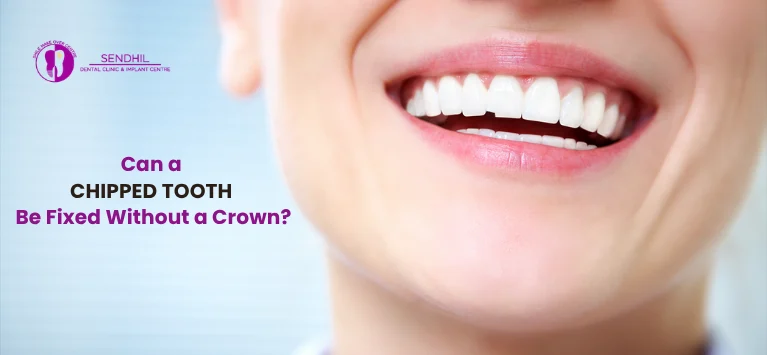 Can-a-Chipped-Tooth-Be-Fixed-Without-a-Crown