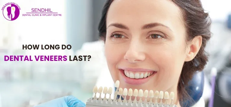 How-Long-Do-Dental-Veneers-Last.